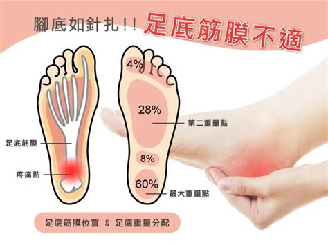 打腳板|足底筋膜炎系列 3 